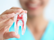 Điều trị tủy răng và những thông tin hữu ích bạn cần biết