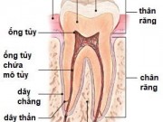 Bị Sâu Răng Nên Bọc Răng Sứ Hay Trám Răng? (nha khoa quận 11)
